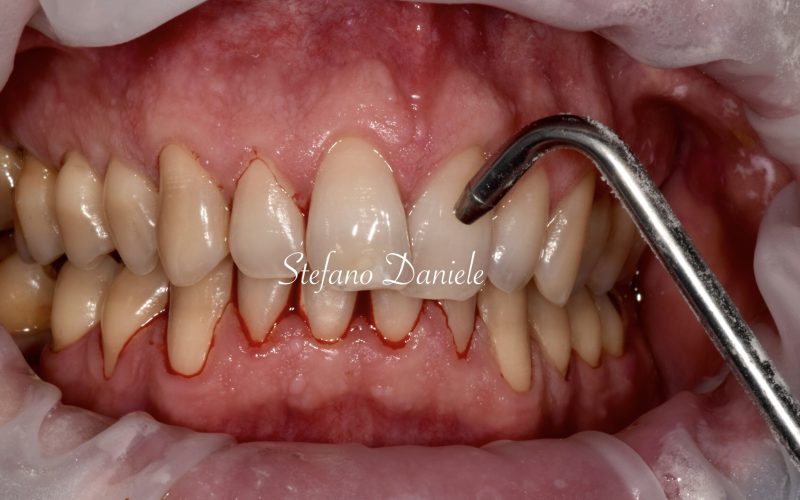2) immagine parodontologia