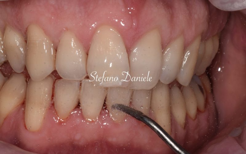 3) immagine parodontologia